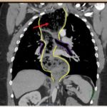 Creative Commons images