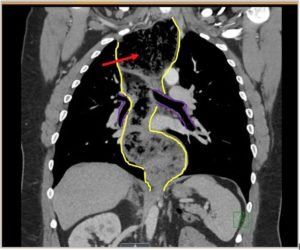 Creative Commons images