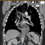 Creative Commons images