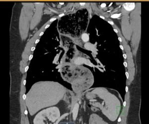 Creative Commons images