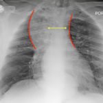 Creative Commons images