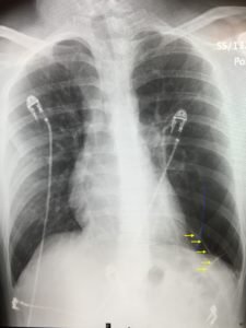 Creative Commons images