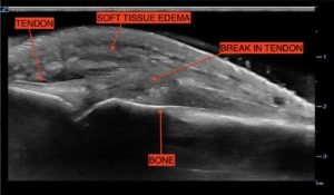 Creative Commons images