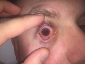 Creative Commons images