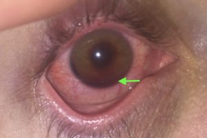 Creative Commons images