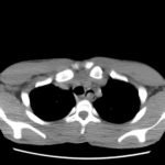 Creative Commons images