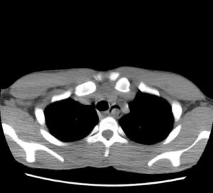 Creative Commons images