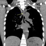 Creative Commons images