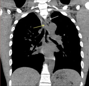 Creative Commons images