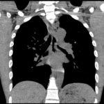 Creative Commons images