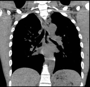 Creative Commons images