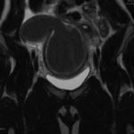 Creative Commons images