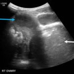 Creative Commons images