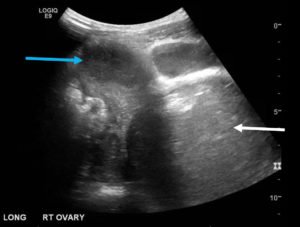 Creative Commons images