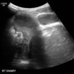 Creative Commons images