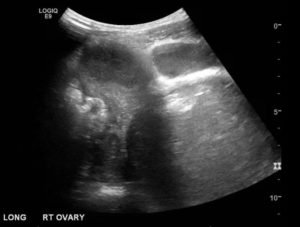 Creative Commons images