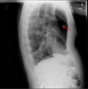 Creative Commons images