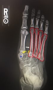 Creative Commons images