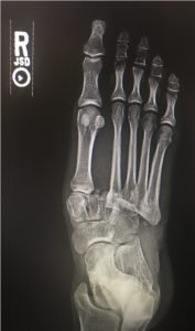 Creative Commons images