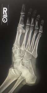 Creative Commons images