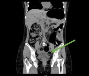 Creative Commons images