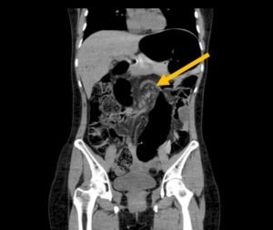 Creative Commons images