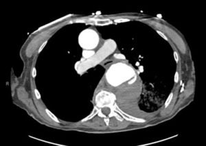 Creative Commons images