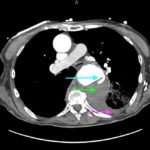 An Unusual Case of Hematemesis 1 Creative Commons images