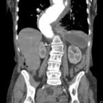 An Unusual Case of Hematemesis 5 Creative Commons images