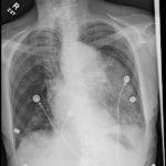 An Unusual Case of Hematemesis 3 Creative Commons images