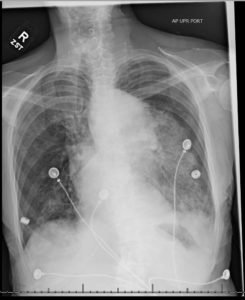 Creative Commons images