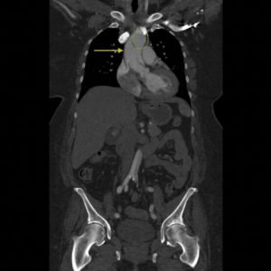 Creative Commons images