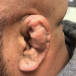 Creative Commons images