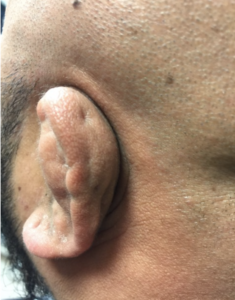 Creative Commons images