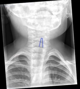 Creative Commons images