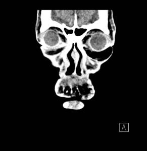 Creative Commons images