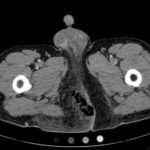 Creative Commons images