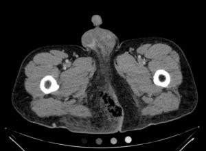 Creative Commons images