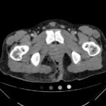 Creative Commons images