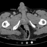 Creative Commons images