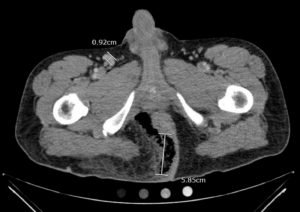 Creative Commons images