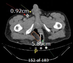 Creative Commons images