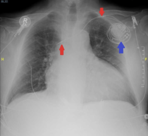 Creative Commons images