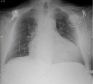 Creative Commons images