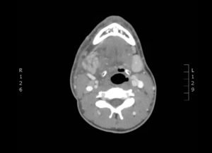 Creative Commons images