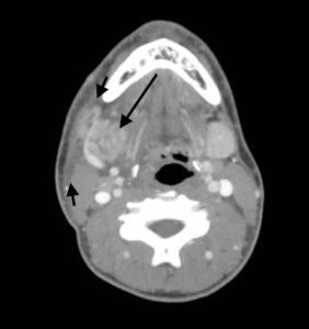 Creative Commons images