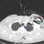 Creative Commons images