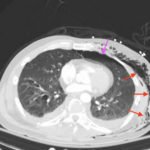 Creative Commons images