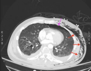 Creative Commons images