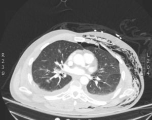 Creative Commons images